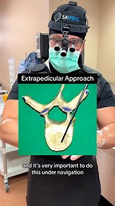 This is the safest way to do spine surgery on patients that have... #doctorreacts #backsurgery #sciaticarelief #spinesurgery #backsurgeryrecovery… @topfans @followers | SASpine