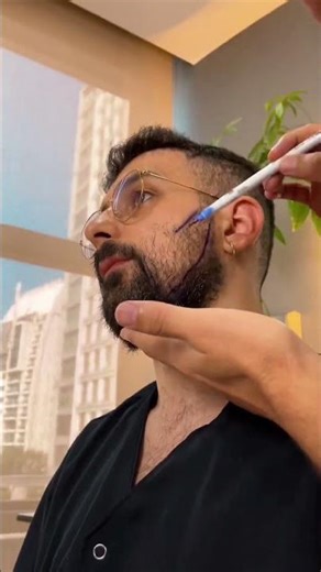 Why Turkey Is the Go To for Beard Transplants The Ultimate Facial Upgrade 🧔✨