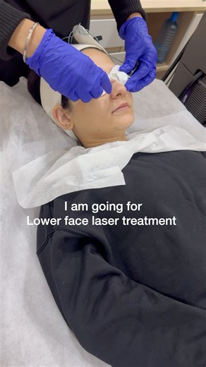 *LASER* hair removal #laser #beauty #laserhairremoval #lasermachine #dayout #shortvideo #lifestyle