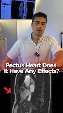 🩺❤️ Cardiac compression in pectus excavatum is not the same for every patient.