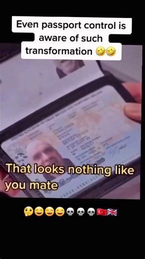 ✈️ Passport Control’s Reaction to Flights from Turkey... 😳 Watch this hilarious clip as passport control gets a bit more than they bargained for, with people coming back from Turkey looking... different! 😂 When the transformation is real! 😅 #UKAmbulanceHumour #PassportControl #TurkeyTransformations #FlyingBackFromTurkey #AmbulanceLife #TravelHumour #TransformationGoals | UK Ambulance Humour