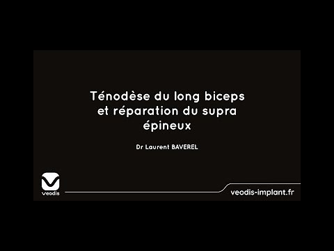 Ténodèse du long biceps et réparation du sus épineux Dr Laurent BAVEREL