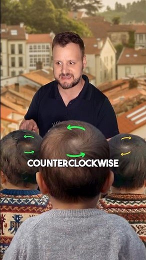 The Mystery of Hair Whorls