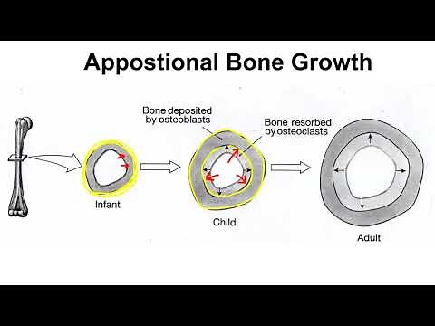 Appositional Bone Growth