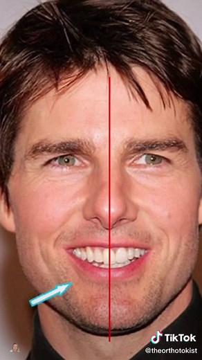 Tom Cruise's 80s Teeth Transformation Revealed