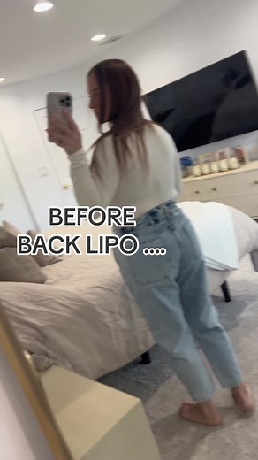 Transformation Journey: Before and After Mommy Makeover Surgery