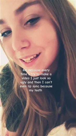 🫩🫩