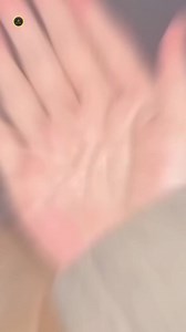 Polydactyly abd syndactyly #viralfact #facts #pregnancy #reel #post #medicaleducation #factvideo #viral | Crazy factor