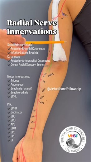 Virtual Hand to Shoulder Fellowship on Instagram: "Sequence of motor innervation for the Radial Nerve: Triceps, Anconeous, Brachialis, Brachioradialis, ECRL, ECRB, Supinator, EDC, ECU, APL, EDM, EPB, EPL, EI. Sensory Innervations: Posterior Brachial Cutaneous, Inferior Lateral Brachial Cutaneous, Posterior Antebrachial Cutaneous, & Dorsal Radial Sensory Branch. 📌At VHSF, we believe foundational knowledge is just the beginning. What distinguishes a specialist from a generalist is the ability to 