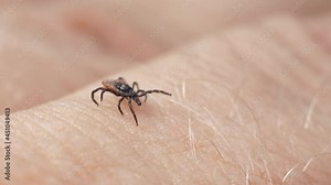 The mite crawls on human skin. Harvest-bug tries to bite a person. Small parasitic insects crawl along the human hand. Ticks carry encephalitis. Creeping blood-sucking mites on human skin