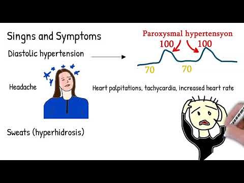 Pheochromocytoma - symptoms, causes, treatment. made simple.