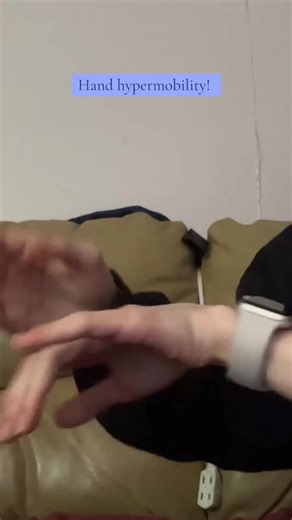 Understanding Hand Hypermobility Symptoms and Care