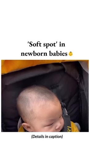 BIOLOGY | MEDICAL | HEALTH on Instagram: "• Fontanelles are soft spots on the baby’s head where the skull bones have not yet completely fused together. Fontanelles are completely normal and important for brain and skull development. The fontanelles should be completely closed by the time the baby is 26 months old. #softspot #fontanelle #medical #interesting"