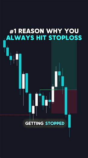 Stop Loss Strategies for Successful Forex Trading