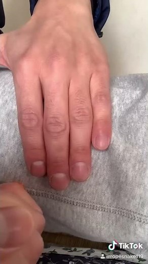 エピペンの使い方