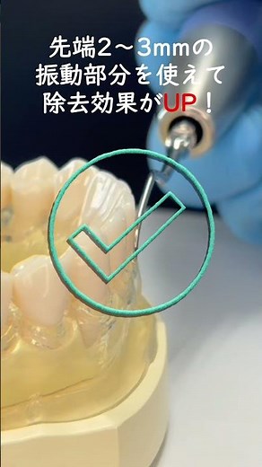超音波チップ先端2〜3mmを歯面に沿わせるだけで効率アップ