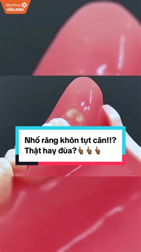 Nhổ răng khôn tụt cân!!? Thật hay đùa? #nhakhoavananh #nhakhoauytin #rangkhon #xuhuong #hanoi