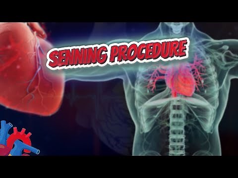 Senning procedure - Human Heart ❤️ and Cardiology ❤️🔊✅