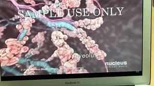 78K views · 700 reactions | Dr D Better Life: 278 (Video) കൊറോണ...