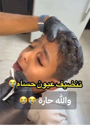 تنظيف عيون حسام: الطريقة الفعالة لعلاج الصديد