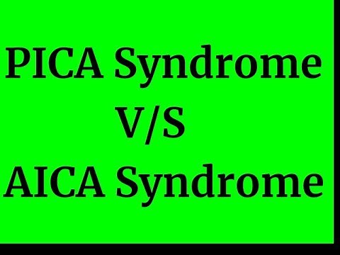PICA V/S AICA Syndrome