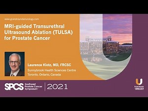 MRI-guided Transurethral Ultrasound Ablation (TULSA) for Prostate Cancer