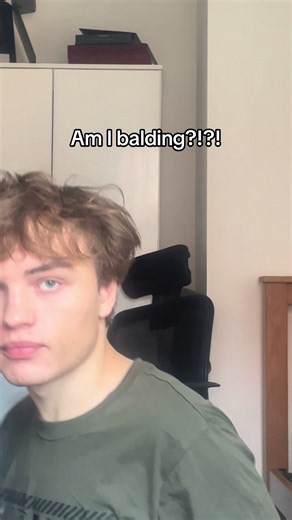 Am I Balding? Signs, When to Act, and Treatment Options