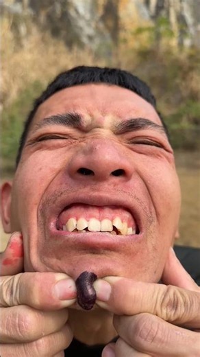 One Tiny Spot Turns Into a Funny Beard Problem! 🤭😁😃😁