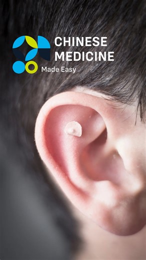 Have you heard of ear seeds?  These tiny tools are used in...