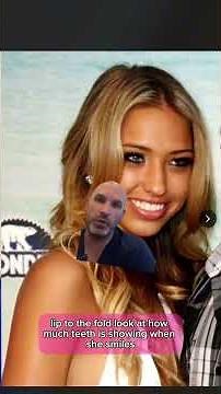 Bre Tiesi Before and After Plastic Surgery