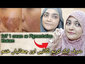 How To Remove Pigmentation || Remove Pigmentation Just Use This Cream | staywithmddiha