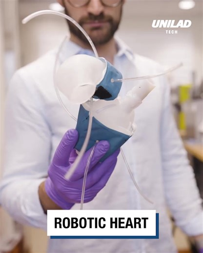 This 3D-printed heart could be a life saver!🤖♥ | UNILAD Tech