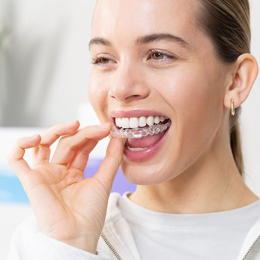 Teeth Aligners & Teeth Straightening – Smile White