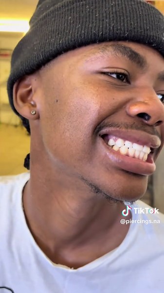 Tooth Gems and Fashion Braces Available Now