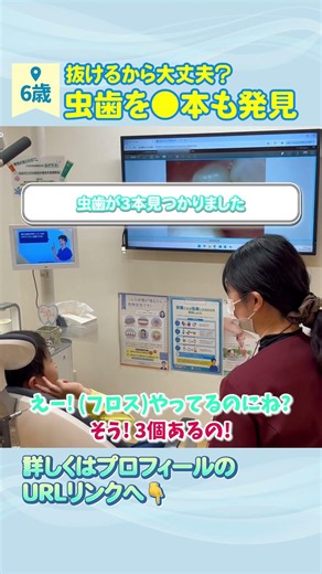 【6歳の歯医者さん】虫歯を◯本発見も抜けるから大丈夫？ #小児歯科 #歯医者 #京都