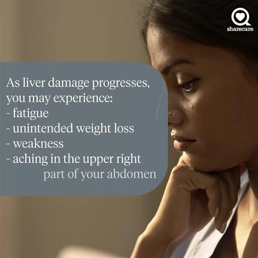 5 things you need to know about fatty liver disease (MASH)