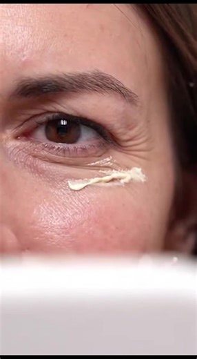 Do you have obvious wrinkles around your eyes? 😔 This essence absorbs quickly and effectively reduces fine lines! If you keep using it, even the fine lines will disappear! @mc.xuan Haha! #Anti-aging Essence #Turmeric Essence #Reduce Fine Lines #Tighten Skin #Good Skincare Product