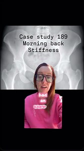 118K views · 11K reactions | Case 189: Morning Back Stiffness She’s 24. Active. Healthy - until she wasn’t. Months of deep back pain, morning stiffness, and a fatigue she couldn’t shake. Was it stress? Bad posture? Something else entirely? She was told it was all in her head…so what’s the diagnosis? #Case189 #MedicalMystery #ladyspinedoc #SundayCaseStudy | Dr. Betsy Grunch - Ladyspinedoc | Facebook