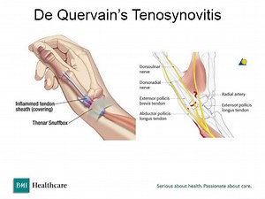 Hand, Wrist, and Elbow | Fremont Orthopedic & Rehabilitation Medicine