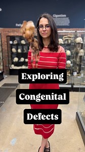 7.9K views · 61K reactions | This tiny skeleton tells a big story. In this video, we explore the case of an infant with congenital rickets, spina bifida, and hydrocephalus—three serious developmental conditions that affect the skeleton from the very beginning of life. From bowed limbs to an enlarged skull and exposed vertebrae, we’ll break down how these conditions form, what they look like in bone, and what they reveal about the challenges of early development. | The Bone Museum | Facebook