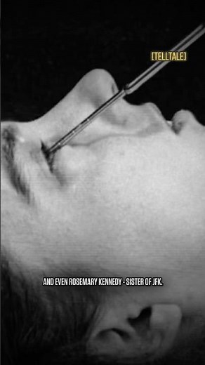 How One Doctor Ruined Thousands Of Minds #shorts