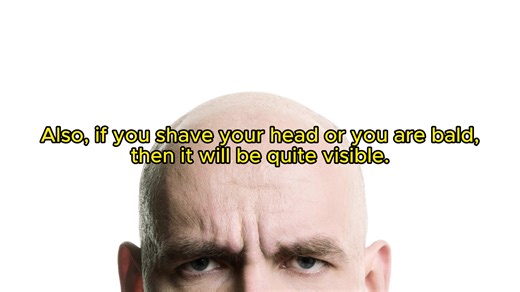 Dent in Your Head From Wearing Headphones/Headset #tips #gaming #headphones #headset #health #rodneyreynolds #3dgameman