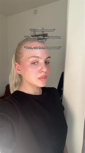 Understanding Nose Job Results and Recovery Time