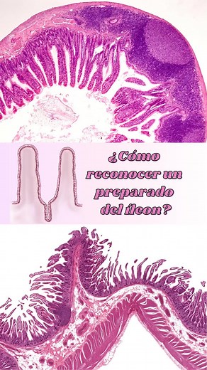 Estructura y Función del Íleon en el Intestino Delgado