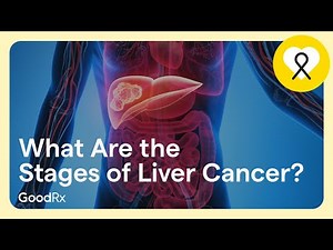 What Are the Stages of Liver Cancer? | GoodRx