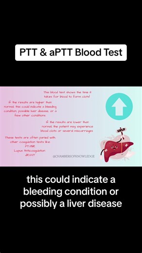 Understanding PTT & aPTT Blood Tests for Coagulation Disorders