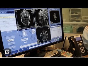 RAD Tech week! | What is it like being an MRI tech for 8 years | MRI MAN PODCAST