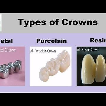 Types of Dental Caps | Crowns