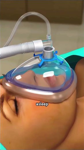 Maxillary Osteotomy Procedure (3D Animation) #anatomicalvariation #medicalanimation #anatomymodel