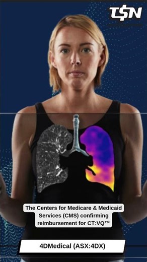 4DMedical Limited (ASX: 4DX): FY25 Annual General Meeting & Quarterly Activities Report